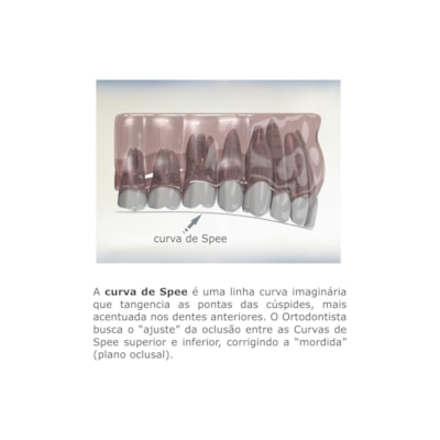 Arco Intraoral Curva Reversa-SPEE Superelástico Grande NiTi - 0,43x0,63mm(.017"x.025") - Morelli