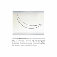 Arco Niti Superelástico Curva Reversa Spee Redondo M - 020 (5070034) - Morelli