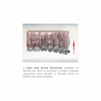 Arco Niti Superelástico Curva Reversa Spee Redondo M - 020 (5070034) - Morelli