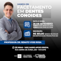 Curso Facetamento em Dentes Conoides Hands-On (Tarde) - SDI