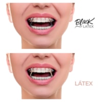 Elástico Intraoral - Antimicrobiano Black  - Morelli