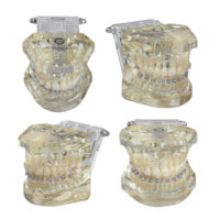 Kit Bráquete Cerâmico Iceram-P Roth 5 Casos + 1 Manequim Misto Grátis - Orthometric