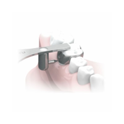 Marcador de Bandas - Tipo Estrela (3.5mm - 5.0mm) - Morelli