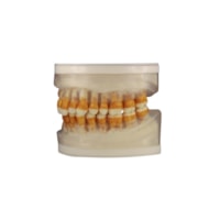 Refil Periodontia I AC 104 - Pronew