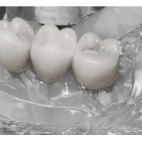 SILICONE DE ADIÇÃO VESTIGE CLEAR THX REF: 1l5100-1X50ML